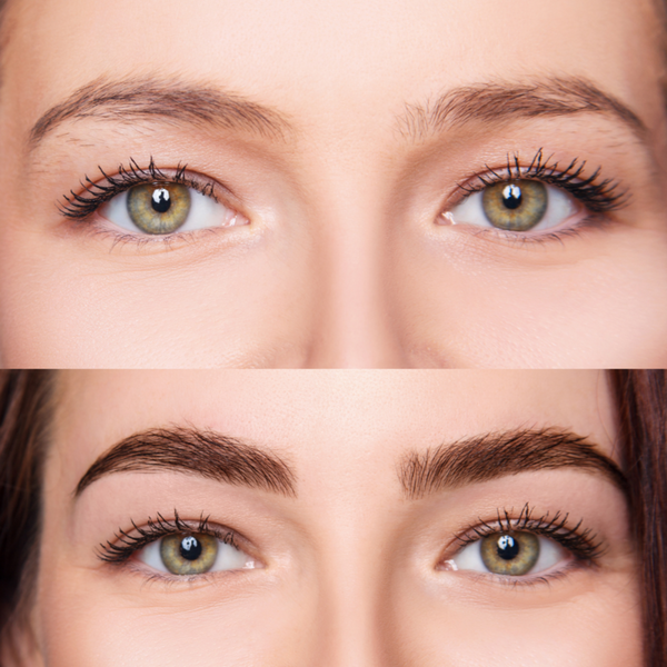 Best Natural Remedies for Brow Growth